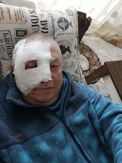Падение на камнях закончилось операцией