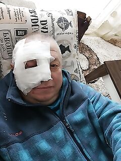 Падение на камнях закончилось операцией