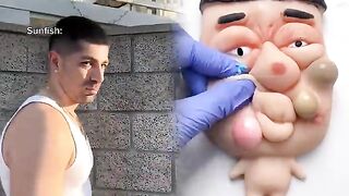 Normal fish vs sunfish when you catch them