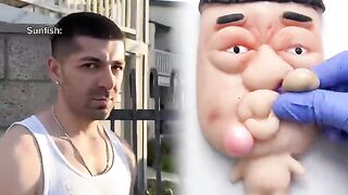 Normal fish vs sunfish when you catch them