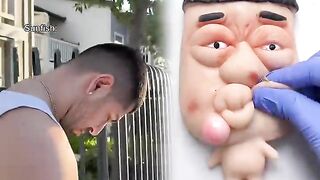 Normal fish vs sunfish when you catch them