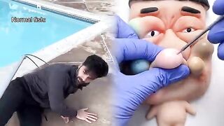 Normal fish vs sunfish when you catch them