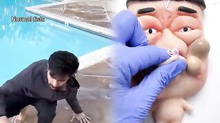 Normal fish vs sunfish when you catch them