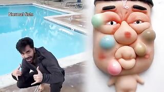 Normal fish vs sunfish when you catch them