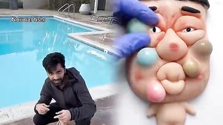 Normal fish vs sunfish when you catch them